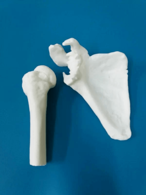 3d ендропротези