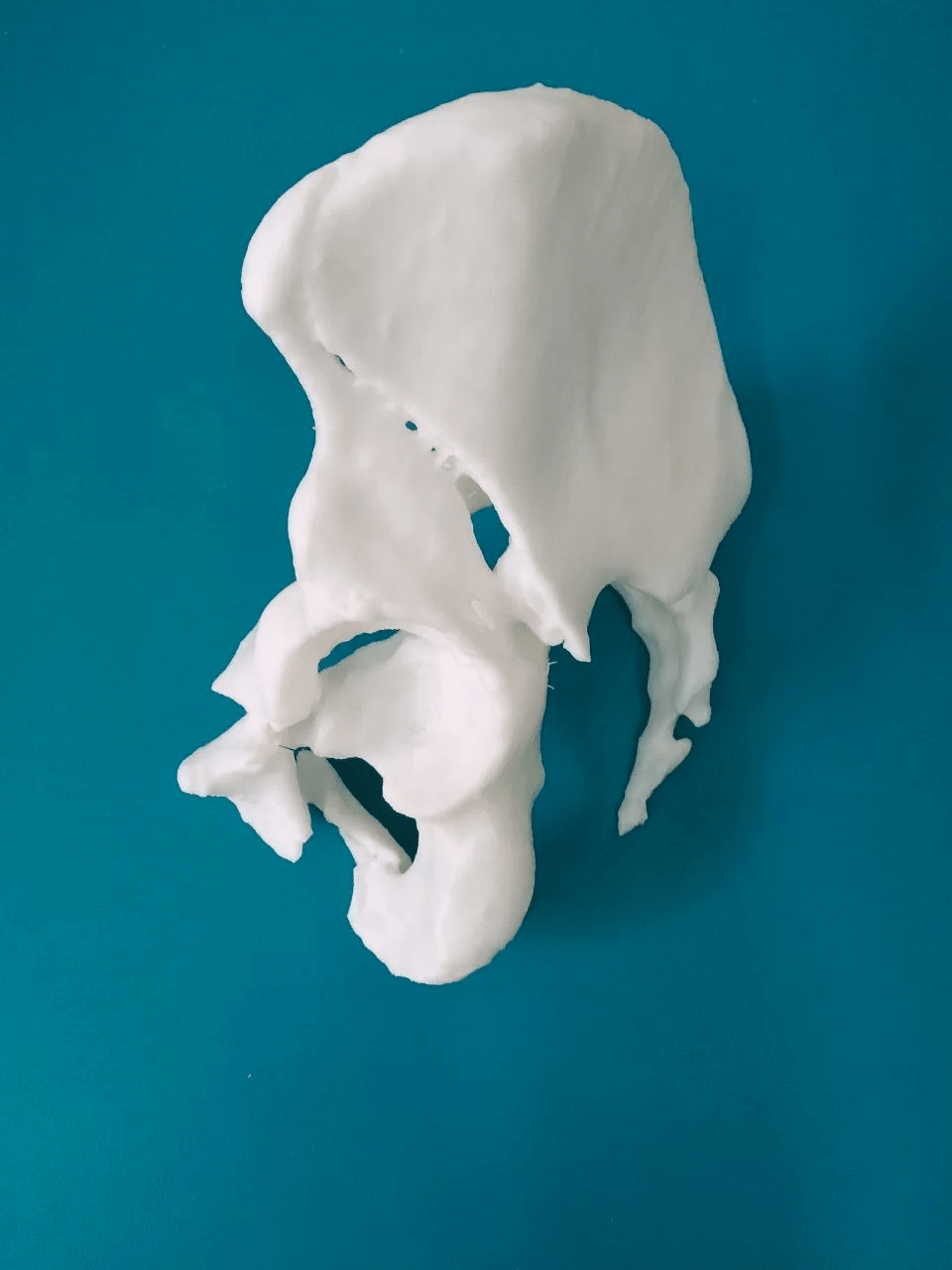 ендропротез